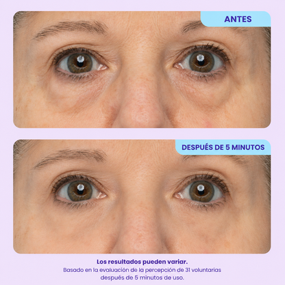 Instant Lift Eye Gel™ | Lifting Instantáneo para una Mirada Más Joven ⭐