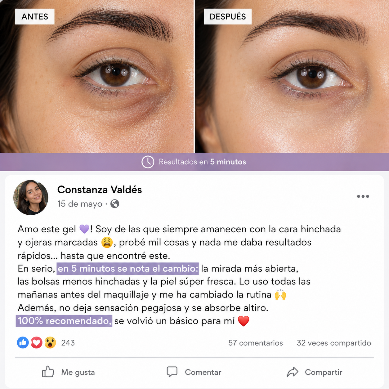 Instant Lift Eye Gel™ | Lifting Instantáneo para una Mirada Más Joven ⭐