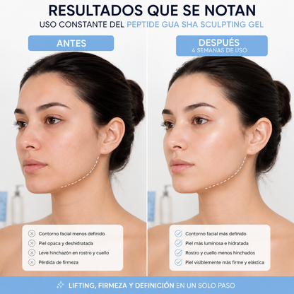 Derx™ V-Mode| Define la Papada y Reafirma el cuello