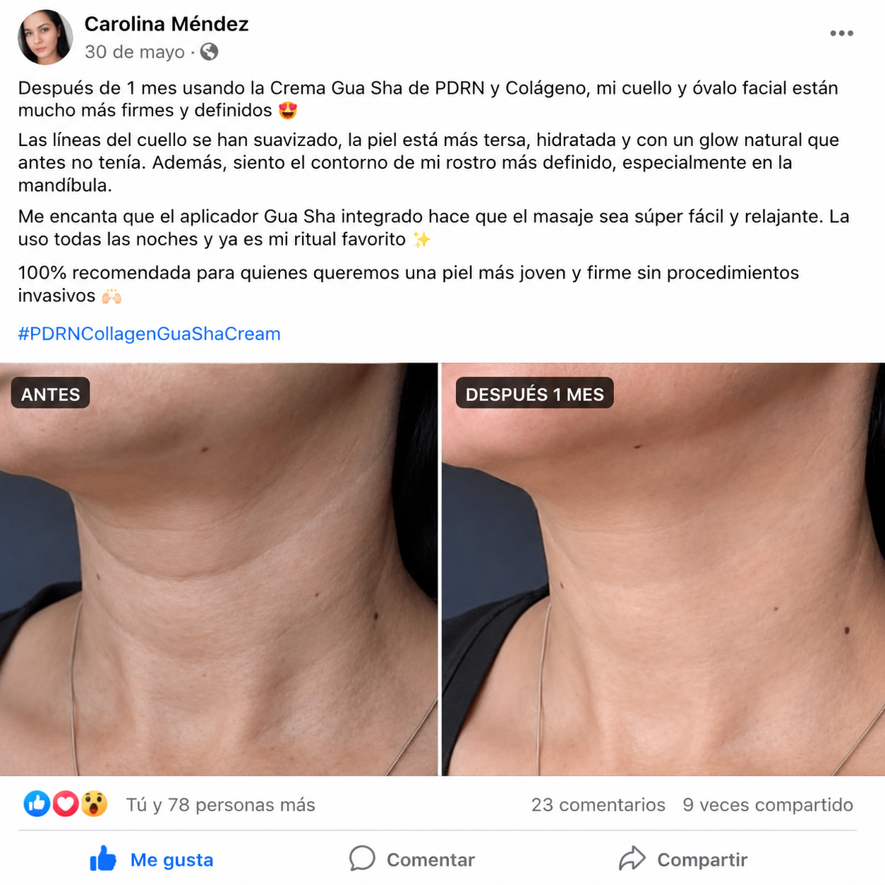 Derx™ V-Mode| Define la Papada y Reafirma el cuello
