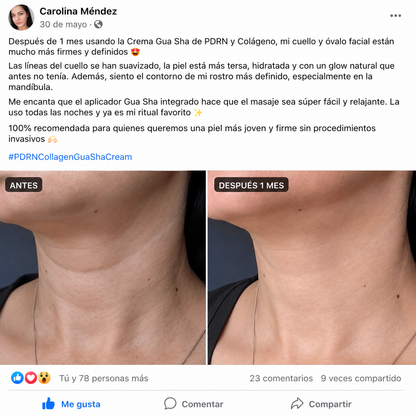 Derx™ V-Mode| Define la Papada y Reafirma el cuello