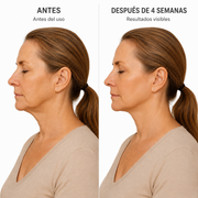Face Shaper Nocturno| Reafirmante de Papada