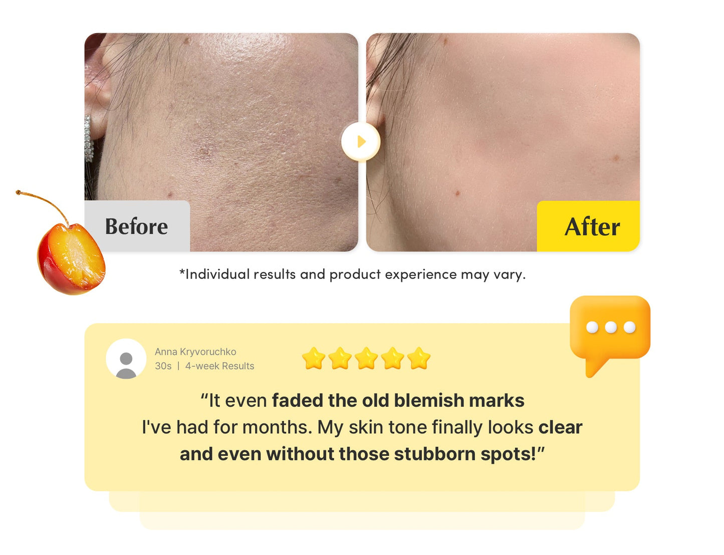[Amazon No.1 ] Vitamin Illuminating Dark Spot Serum