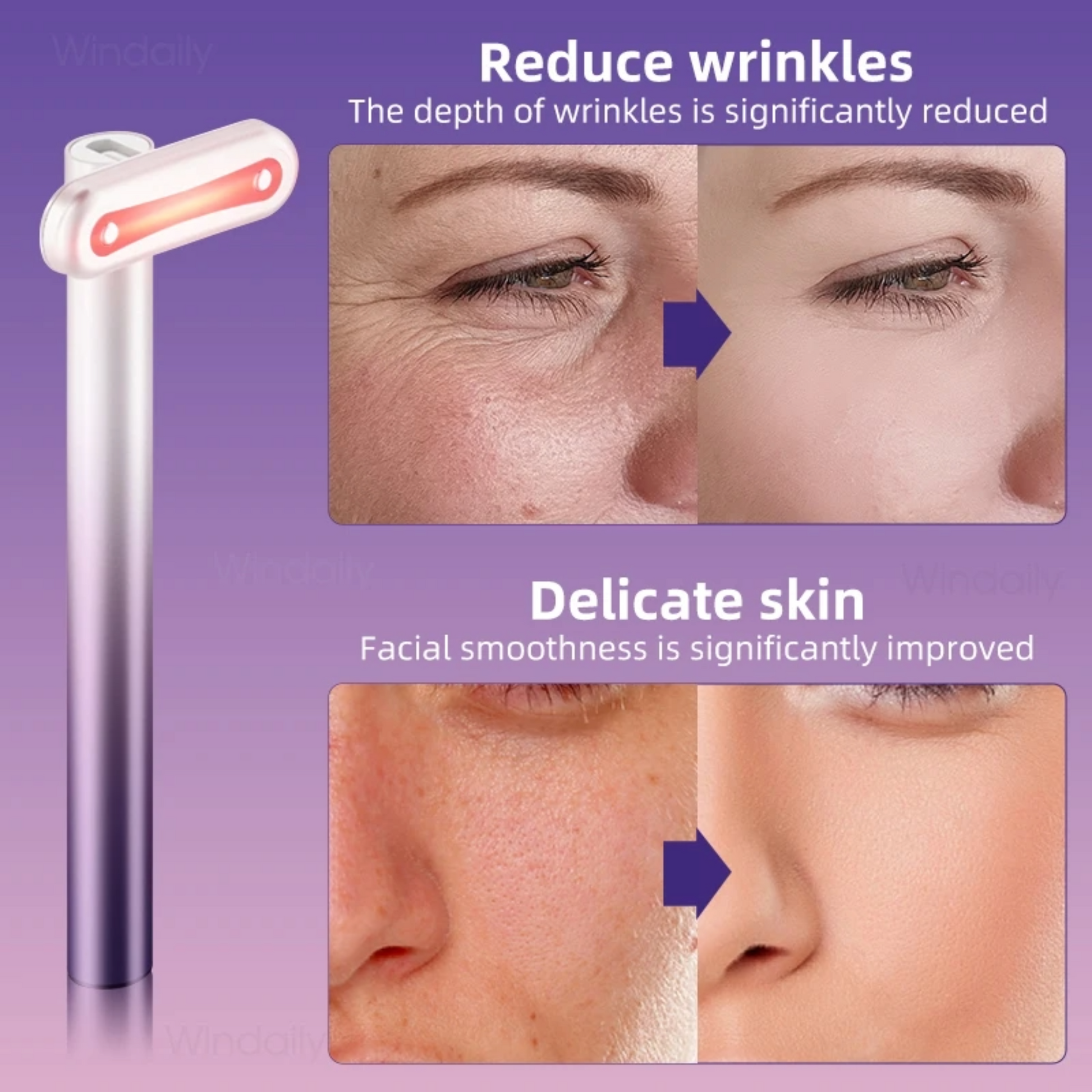 Red Light Therapy Wand with before and after photos showing reduction in wrinkles and smoothing of sensitive skin.