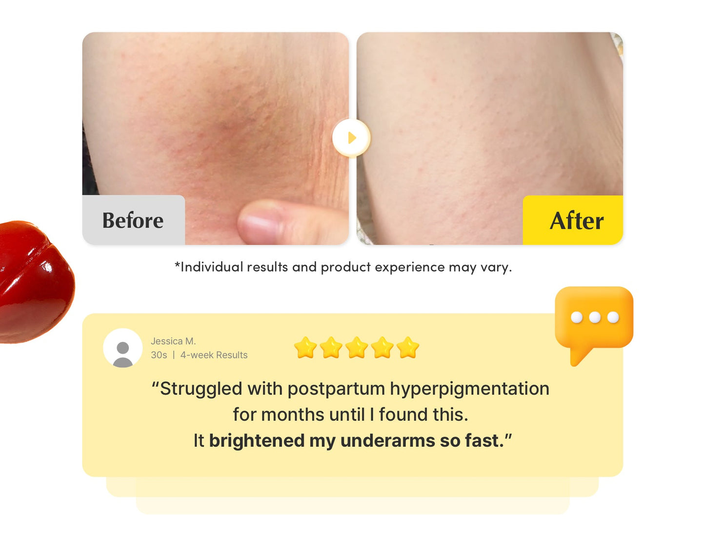 [Amazon No.1 ] Vitamin Illuminating Dark Spot Serum
