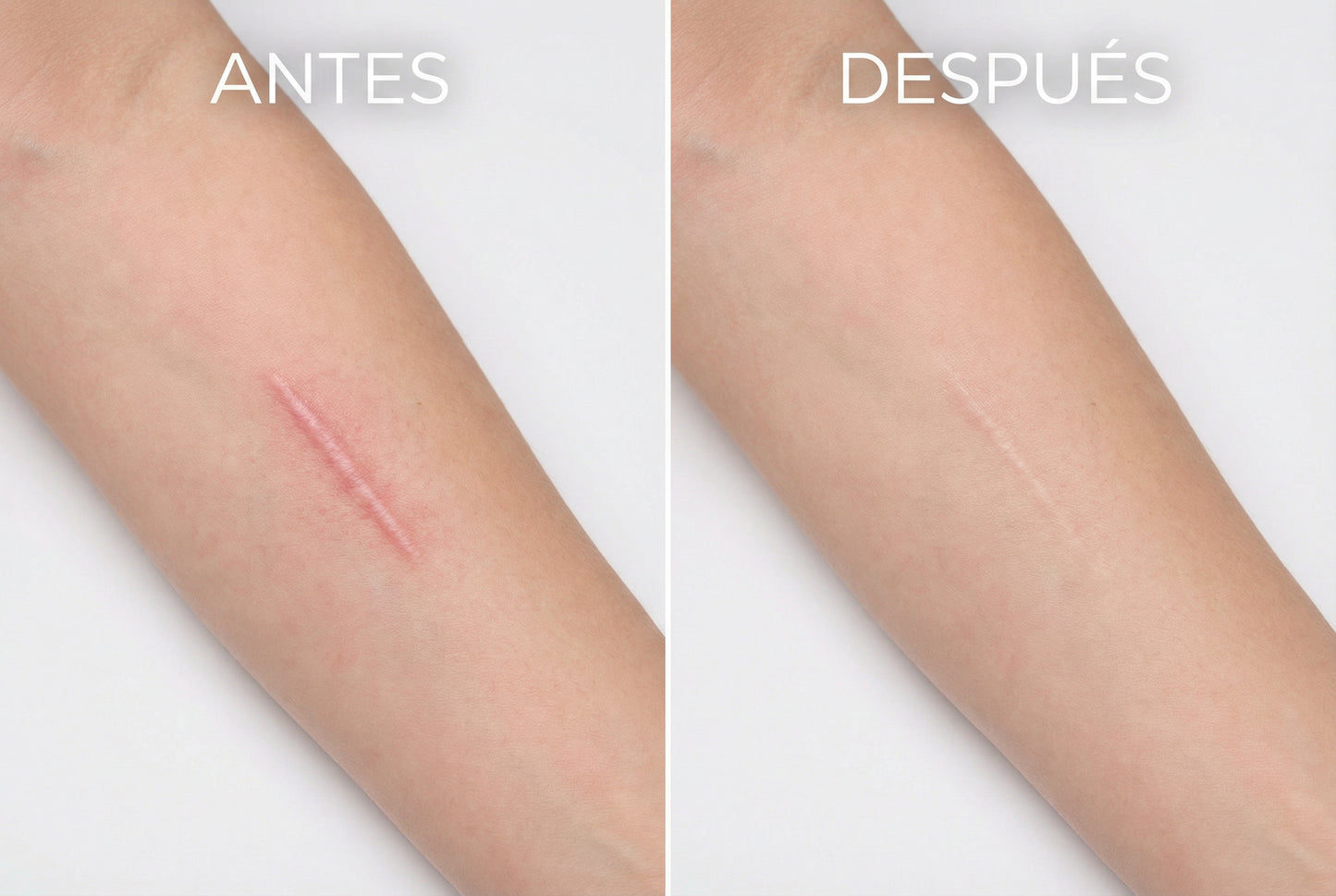 Stick Reparador de Cicatrices con Silicona Médica – Suaviza y Reduce Marcas Visibles